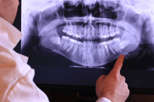 Best Broken or Cracked Tooth Emergency Dentist in Rio Del Mar, CA